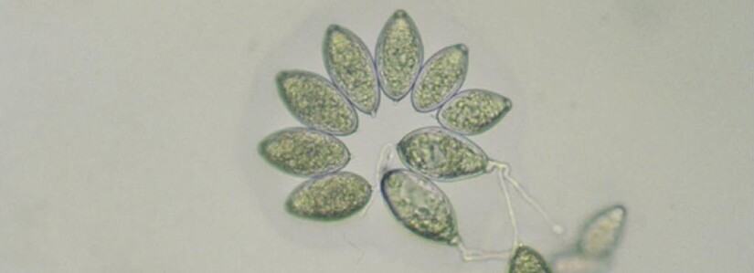 Bild: Sporen von Phytophthora ramorum