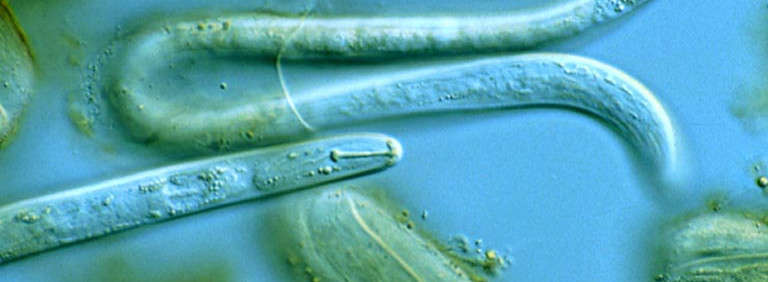 Bild: Larve eines Kartoffelzystennematoden