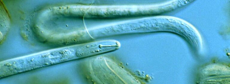 Bild: Larve eines Kartoffelzystennematoden